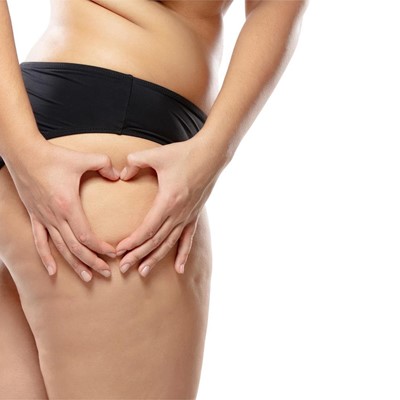 ¿Cómo combatir la celulitis?
