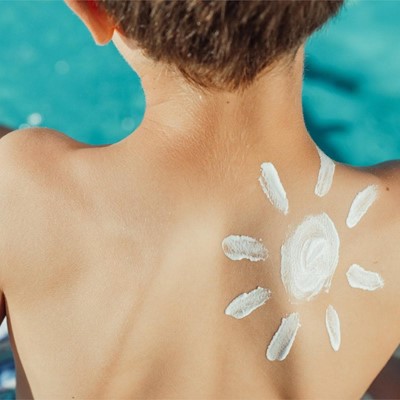 Importancia del uso de protector solar durante los meses de verano
