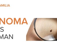 MELANOMA AVANCES QUE SUMAN